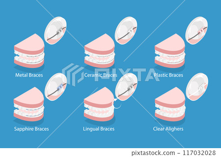 3D Isometric Flat Vector Illustration of Dental Teeth Braces Types, Orthodontic Options for Teeth Straightening 117032028