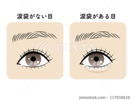 Eyes with and without tear bags Eyes with and without tear bags 117038638