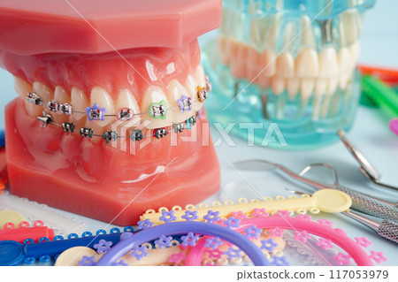Orthodontic ligatures rings and ties, elastic rubber bands on orthodontic braces, model for dentist studying about dentistry. 117053979