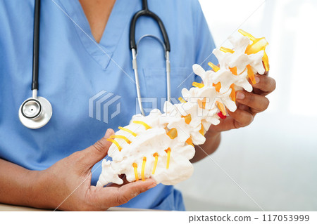 Asian doctor holding spinal nerve and bone model, Lumbar spine displaced herniated disc fragment for treatment medical in the orthopedic department. 117053999