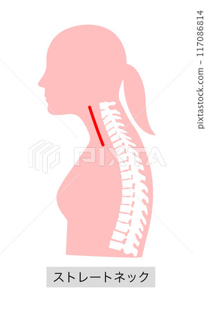 骨骼圖解說明直頸女性上半身 骨骼圖解說明直頸女性上半身 117086814