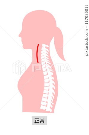 Skeletal illustration of a woman's upper body in normal posture with explanation Skeletal illustration of a woman's upper body in normal posture with explanation 117086815