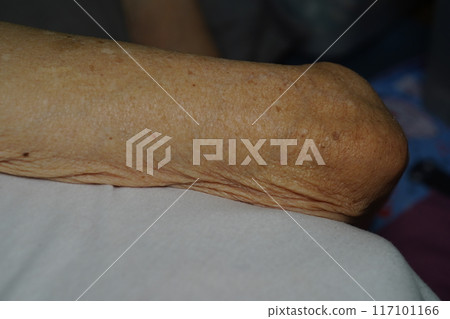 長照 117101166