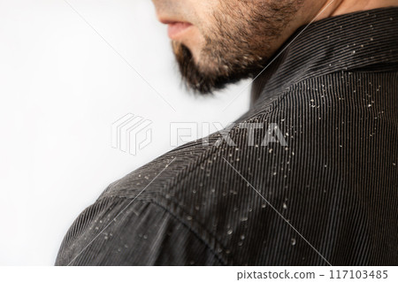 Close-up of a man's shoulder in a black shirt covered with dandruff. The concept of psoriasis and skin problems 117103485