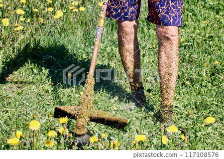 While cutting dandelions with gasoline-powered weed trimmer, man did not protect his legs from crushed grass. While cutting dandelions with gasoline-powered weed trimmer, man did not protect his legs from crushed grass. 117108576
