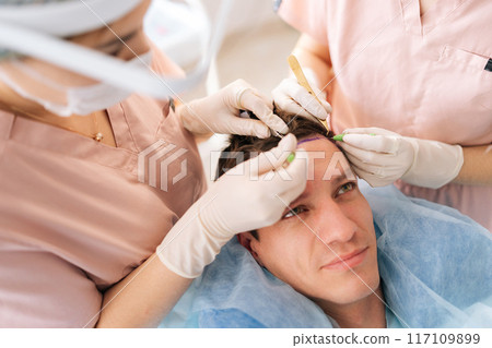 High-angle view of trichologist surgeons carry out hair transplant surgery in operating room to male patient with hairloss problem. Surgical technique that moves hair follicles from part of head. 117109899