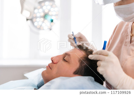 Closeup side view of unrecognizable female nurse drawing using pencil new hairline on head of patient male before hair transplantation surgery in clinic. Concept of professional baldness treatment. 117109926