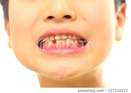 Regeneration from deciduous teeth to permanent teeth 117110212