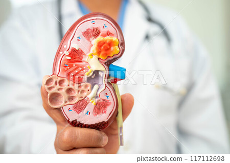 Kidney disease, Chronic kidney disease ckd, Doctor hold human model to treat and study in hospital. Kidney disease, Chronic kidney disease ckd, Doctor hold human model to treat and study in hospital. 117112698