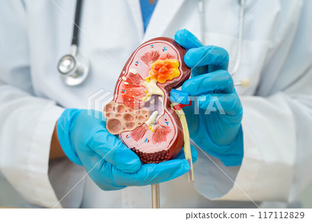 Kidney disease, Chronic kidney disease ckd, Doctor hold human model to treat and study in hospital. Kidney disease, Chronic kidney disease ckd, Doctor hold human model to treat and study in hospital. 117112829