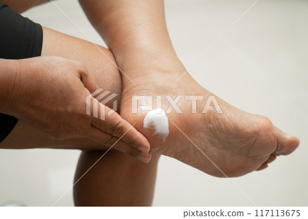 Asian woman care feet with cracked and dry heel skin cream at home. 117113675