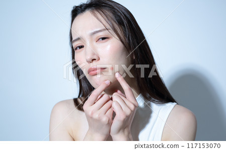 Image of a woman suffering from acne 117153070