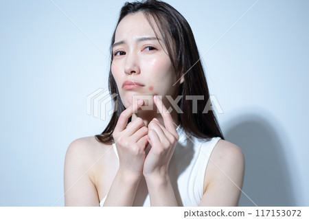 Image of a woman suffering from acne 117153072