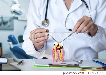 Showing a Model of a Damaged Tooth . Showing a Model of a Damaged Tooth . 117173148