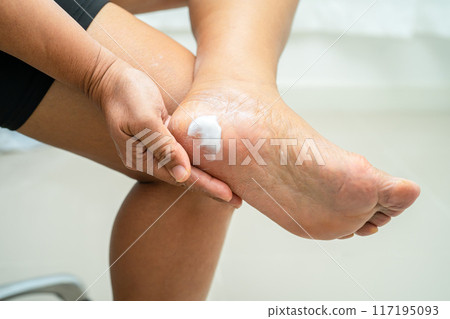 Asian woman care feet with cracked and dry heel skin cream at home. 117195093