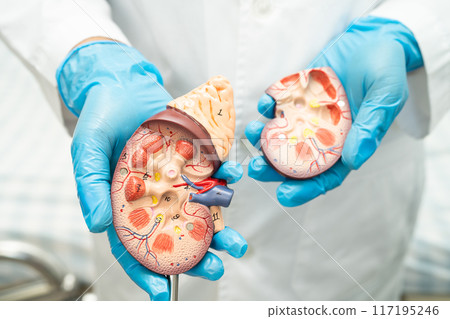 Kidney disease, Chronic kidney disease ckd, Doctor hold human model to treat and study in hospital. 117195246