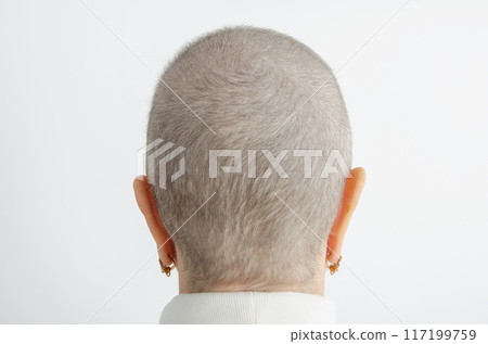 Hopeful Signs: Fine Hair Returns 70 Days After Chemotherapy in Woman's Recovery Journey. Hopeful Signs: Fine Hair Returns 70 Days After Chemotherapy in Woman's Recovery Journey. 117199759