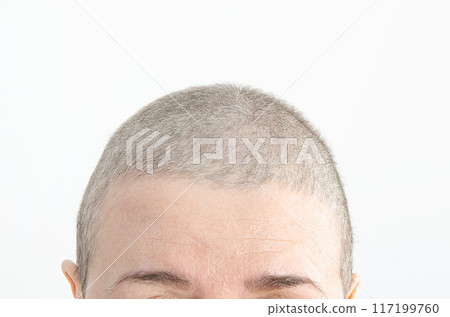 From Loss to Growth: 62-Year-Old Woman Sees First Signs of Hair Regrowth 70 Days After Chemotherapy. From Loss to Growth: 62-Year-Old Woman Sees First Signs of Hair Regrowth 70 Days After Chemotherapy. 117199760