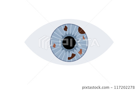 Iris melanoma anatomy 117202278