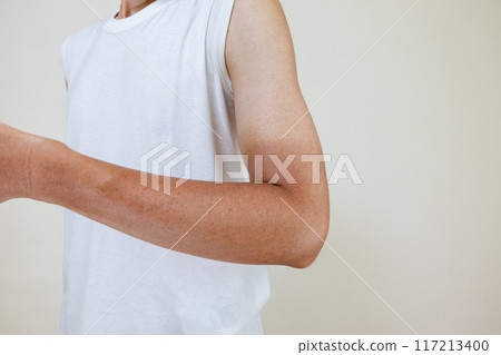 男人手臂有曬傷痕跡 男人手臂有曬傷痕跡 117213400