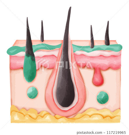 Watercolor Illustration of Hair Follicle with Sebum and Pus Watercolor Illustration of Hair Follicle with Sebum and Pus 117219965