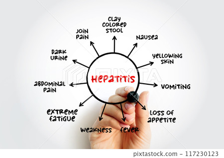 Hepatitis symptoms mind map, medical concept for presentations and reports 117230123