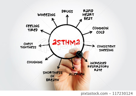 Asthma mind map process, medical concept for presentations and reports 117230124