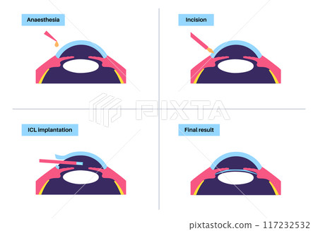 EVO ICL poster 117232532