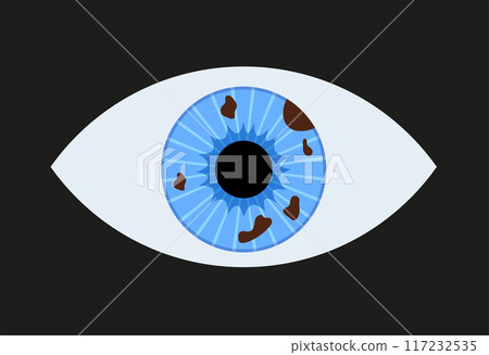 Iris melanoma anatomy 117232535