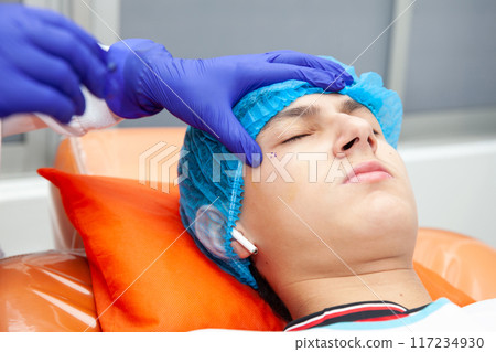 Skin lesion removal procedure. Dermatologist carrying out a removal of benign skin lesion on the face of a young male patient. 117234930