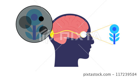 Glaucoma eye disease 117239584