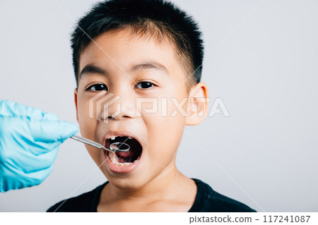 In a pediatric dentist's office a doctor examines a child's mouth post removal of a loose milk tooth. Dental instruments assist in examination. Doctor uses mouth mirror to checking teeth cavity In a pediatric dentist's office a doctor examines a child's mouth post removal of a loose milk tooth. Dental instruments assist in examination. Doctor uses mouth mirror to checking teeth cavity 117241087