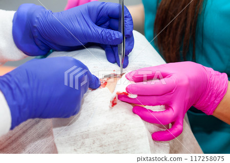 Doctor suturing a patient during a small surgery. Dermatologist carrying out a removal of benign skin lesion on the face of a young male patient. 117258075
