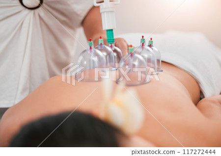 Zoom, physiotherapy or woman with cupping therapy for back pain, physical therapy or relax wellness massage for meditation help.Medicine, medical or luxury health tech for zen in spa for support 117272444