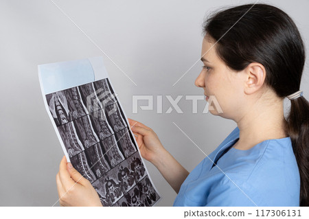 The doctor holds an MRI image of a patient with intervertebral disc protrusion and osteoarthritis of the thoracic spine. The doctor holds an MRI image of a patient with intervertebral disc protrusion and osteoarthritis of the thoracic spine. 117306131