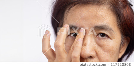 Flabby and wrinkled skin on senior woman face. 117310808