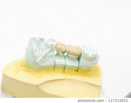 Dental Porcelain Crown 117313652