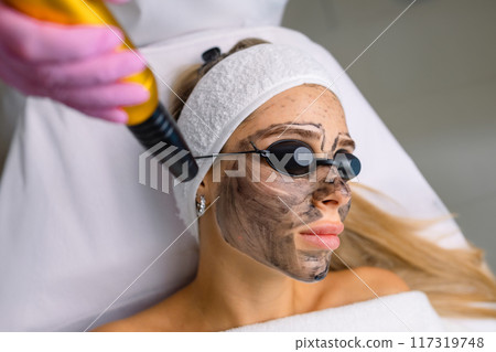 Close-up of cosmetologist's hand making hardware carbon peeling by young pretty customer woman in safety glasses headdress lying on couch in beauty salon. Facial cleaning concept. Cosmetology Services Close-up of cosmetologist's hand making hardware carbon peeling by young pretty customer woman in safety glasses headdress lying on couch in beauty salon. Facial cleaning concept. Cosmetology Services 117319748