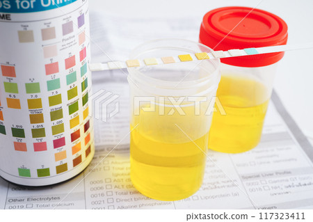 Urinalysis, urine cup with reagent strip pH paper test and comparison chart in laboratory. Urinalysis, urine cup with reagent strip pH paper test and comparison chart in laboratory. 117323411
