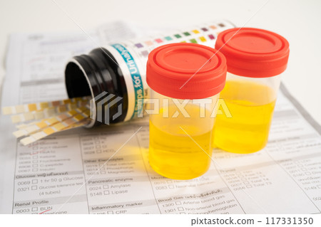 Urinalysis, urine cup with reagent strip pH paper test and comparison chart in laboratory. 117331350
