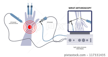 Wrist arthroscopy surgery 117331435