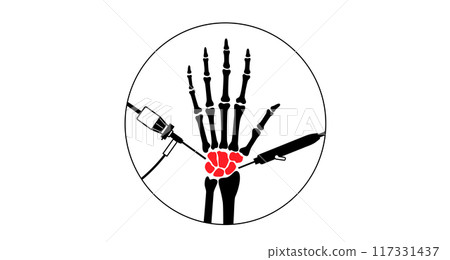 Wrist arthroscopy surgery 117331437
