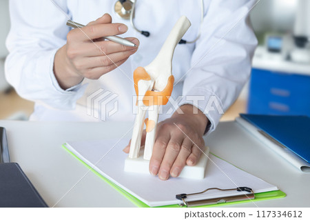 Doctor shows joint problems on model. 117334612