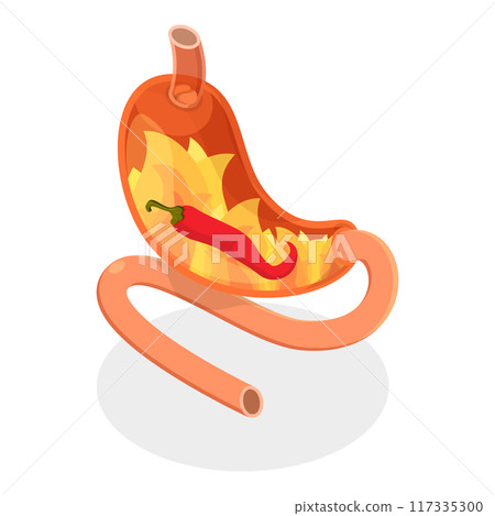 3D Isometric Flat Vector Set of Stomach Problems, Digestive System Issues. Item 1 3D Isometric Flat Vector Set of Stomach Problems, Digestive System Issues. Item 1 117335300