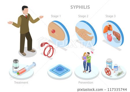 3D Isometric Flat  Illustration of Syphilis, Sexually Transmitted Infection 117335744