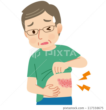 Middle-aged man suffering from pain due to shingles Symptoms 117338675