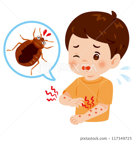 男孩被臭蟲咬後全身發癢 117349725