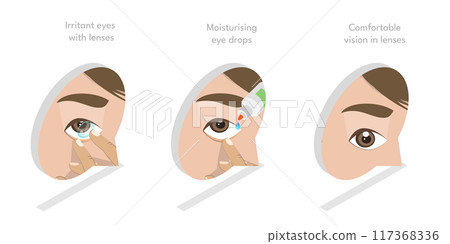 3D Isometric Flat Illustration of Moisturizing Eye Drops, Using of Artificial Tears 3D Isometric Flat Illustration of Moisturizing Eye Drops, Using of Artificial Tears 117368336