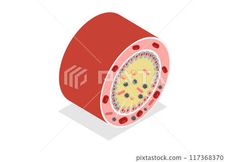 3D Isometric Flat Illustration of Celiac Disease, Gluten Intolerance 3D Isometric Flat Illustration of Celiac Disease, Gluten Intolerance 117368370