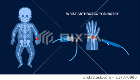 Wrist arthroscopy surgery 117370990
